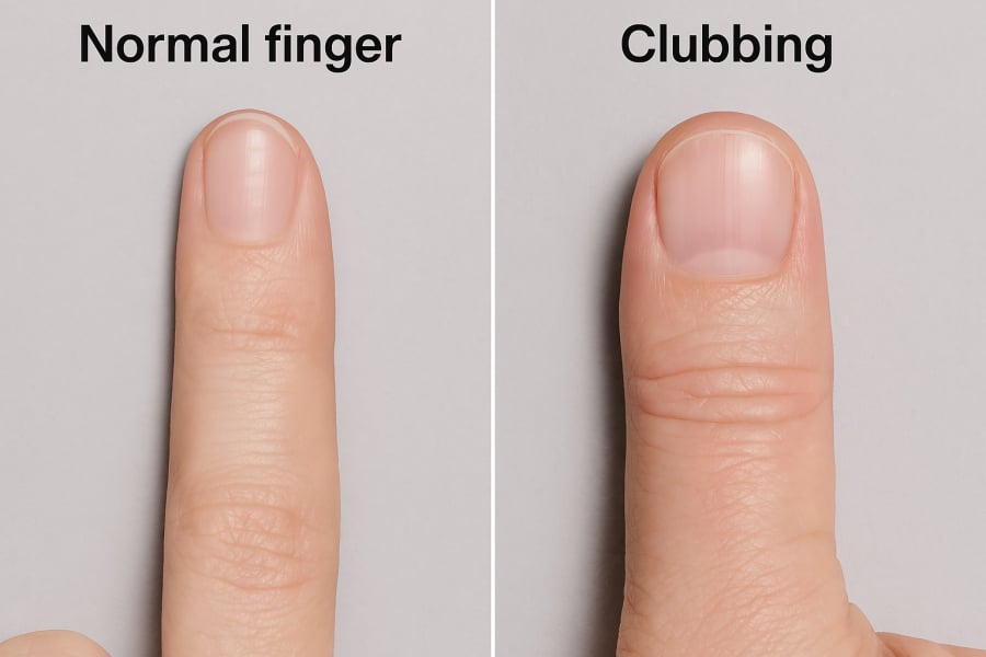 Dấu hiệu này có thể liên quan đến nhiều bệnh lý nghiêm trọng