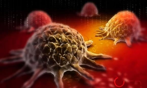 Ung thư là một căn bệnh liên quan đến rối loạn gen. 