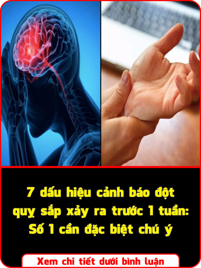 7 dấu hiệu cảnh báo đột quỵ sắp xảy ra trước 1 tuần Số 1 cần đặc biệt chú ý