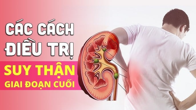 Dấu hiệu bệnh thận nên đi khám trước