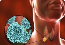 8 thực phẩm không đội trời chung với các khối u, nhắc nhau nhớ ăn thường xuyên