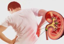 5 dấu hiệu suy thận giai đoạn đầu ở nam giới: Biết sớm tránh chạy thận suốt đời